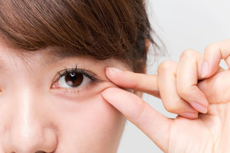 Close-up of fingers lifting the upper eyelid skin to show the eyelid fold