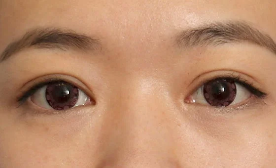 ตา · เปิดหัวตา/หางตา — หลัง
