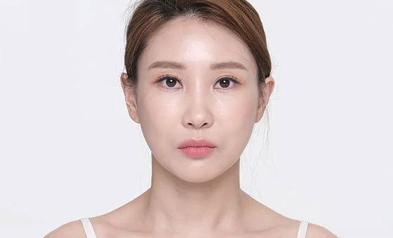 รูปหน้า · ศัลยกรรมแก้ไข — หลัง